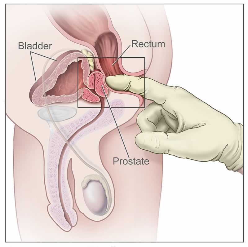 Bild som visar prostatans läge