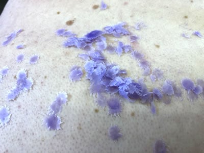 Image showing some of the wax that was scraped easilly off sub'r's skin