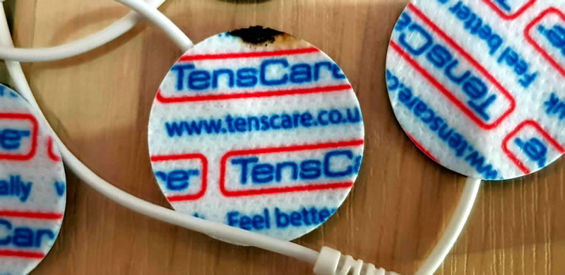 Image montrant une électrode à tampon monopôle avec un bord brûlé Image montrant une électrode à tampon monopôle avec un bord brûlé