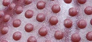 Imagen que muestra la textura de la burbuja