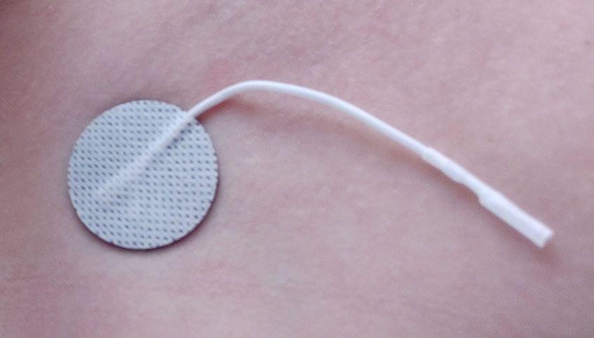 Image showing one of the E-Stim Systems micro pad electrodes on my skin