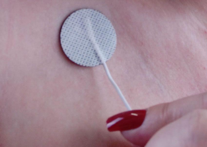 Image showing one of the E-Stim Systems micro pad electrodes on my skin