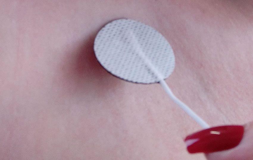 Image showing one of the E-Stim Systems micro pad electrodes being peeled off my skin