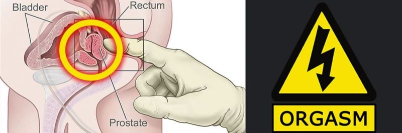 Advice On Achieving E-Stim Prostate Orgasms